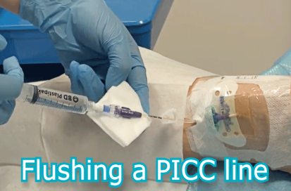 Flushing and Changing the Needle Free Valve of a Peripherally Inserted Central Catheter Line