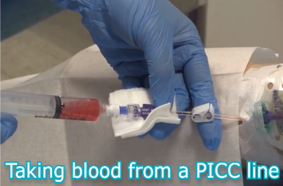 Taking Blood From a PICC Line