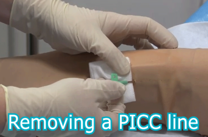 Removing a Peripherally Inserted Central Catheter Line